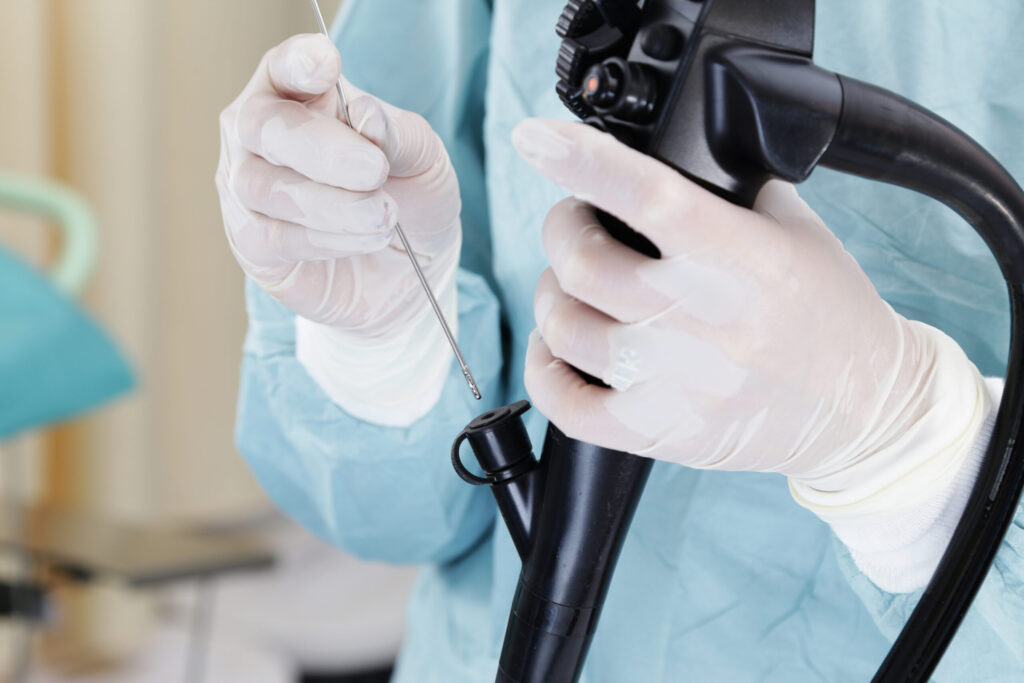 Endoscopic ultrasound (eus) 5 Gastro screening scaled