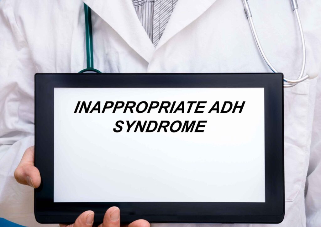 Diagnosis & treatment of siadh (syndrome of inappropriate antidiuretic hormone) 1 Siadh (syndrome of inappropriate antidiuretic hormone)