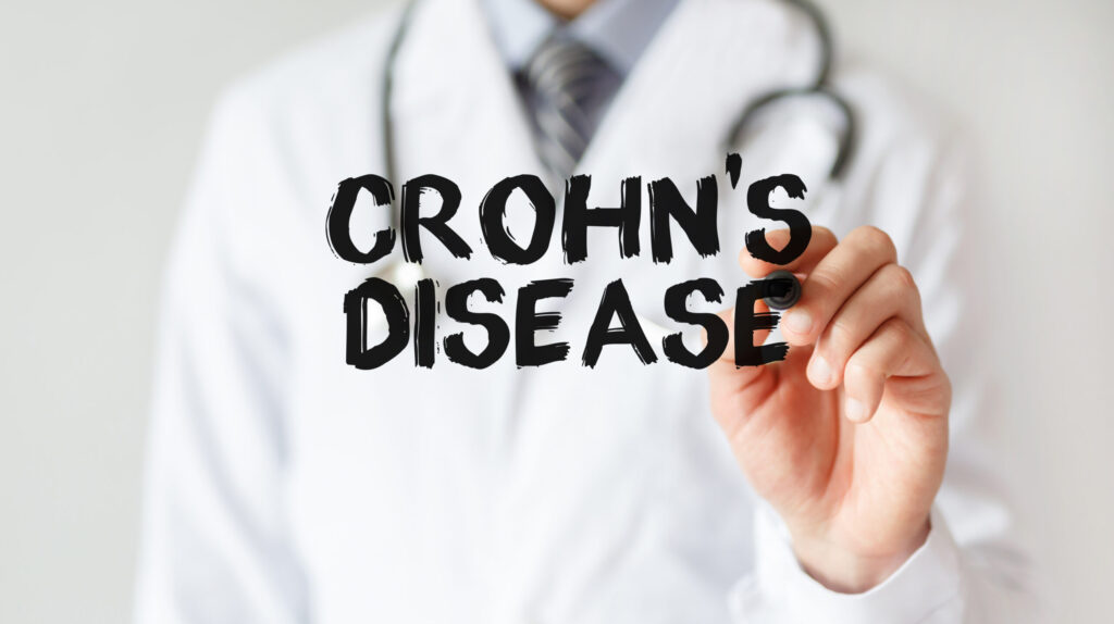 Crohn's disease 7 Crohns disease scaled