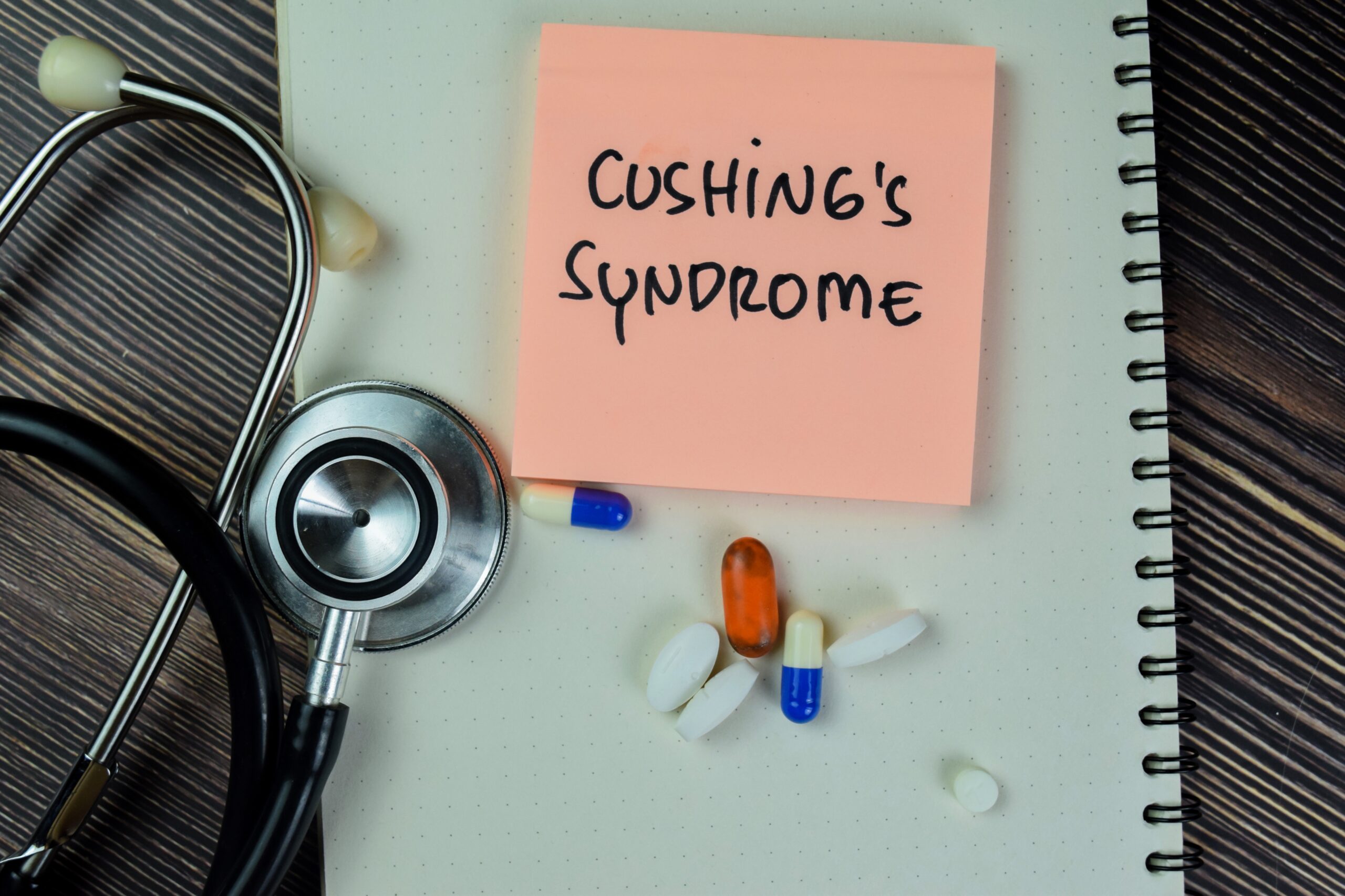 Cushing’s Syndrome