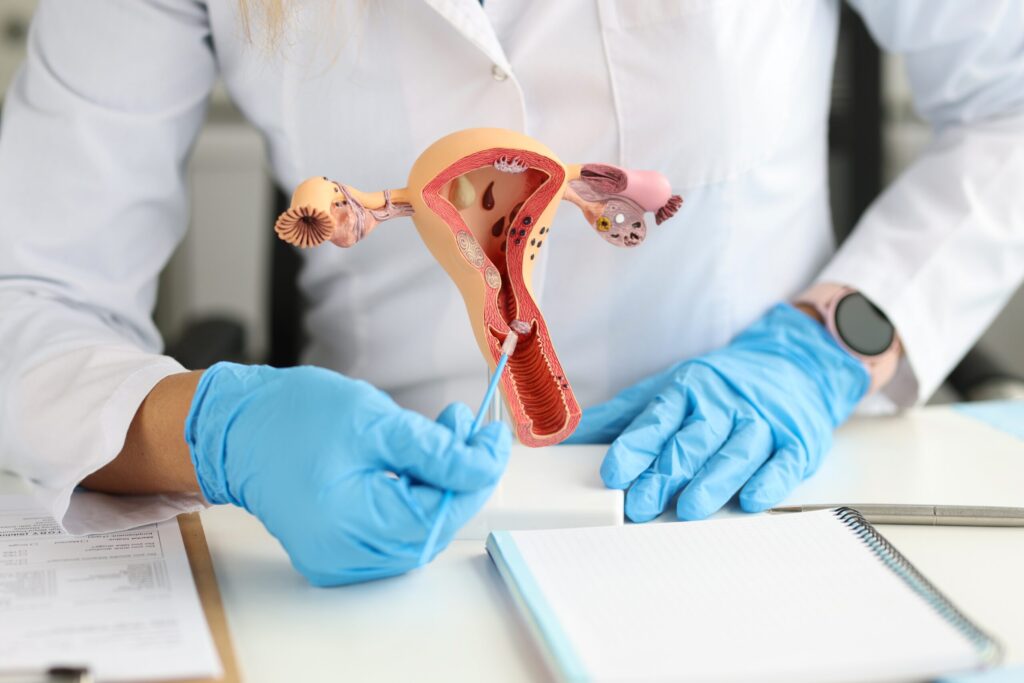 Endometrial cancer