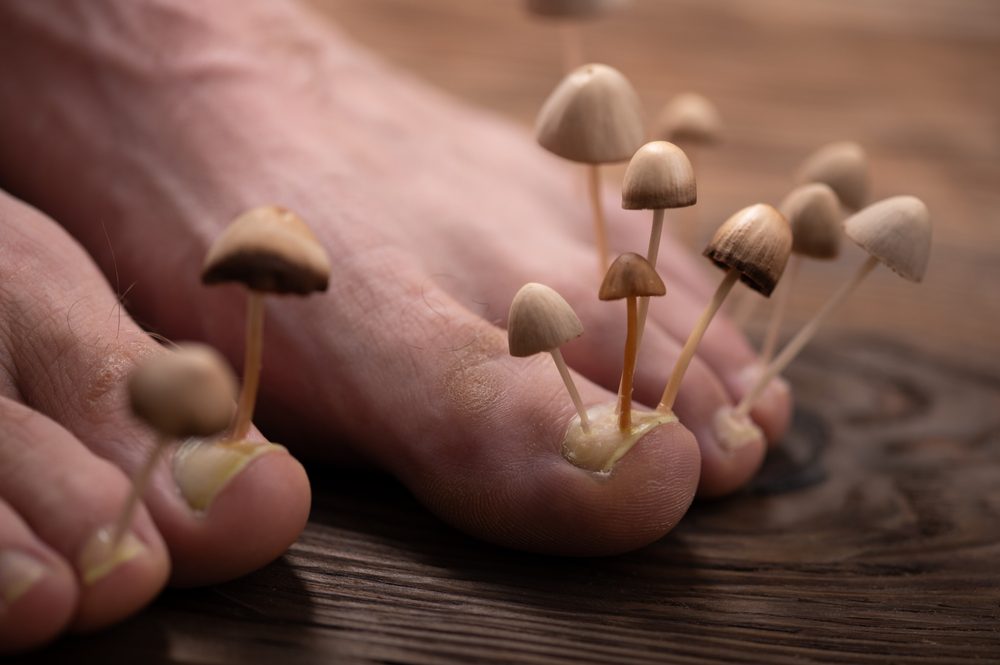 Fungal nail infections