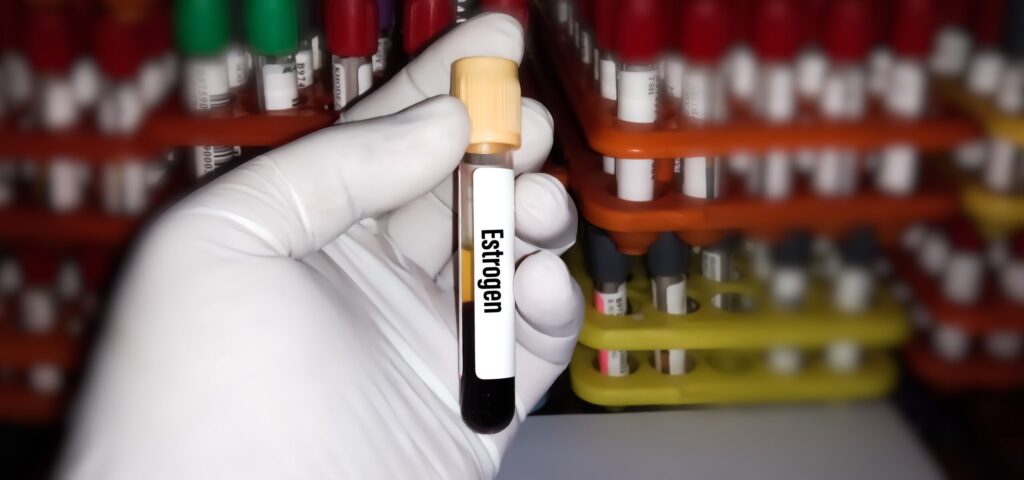 Estrogen level testing 1 Estrogen level testing