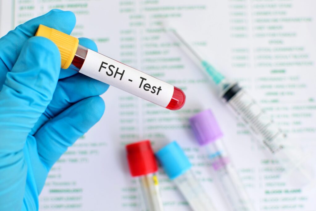 Fsh tests (follicle stimulating hormone test) 1 Fsh test