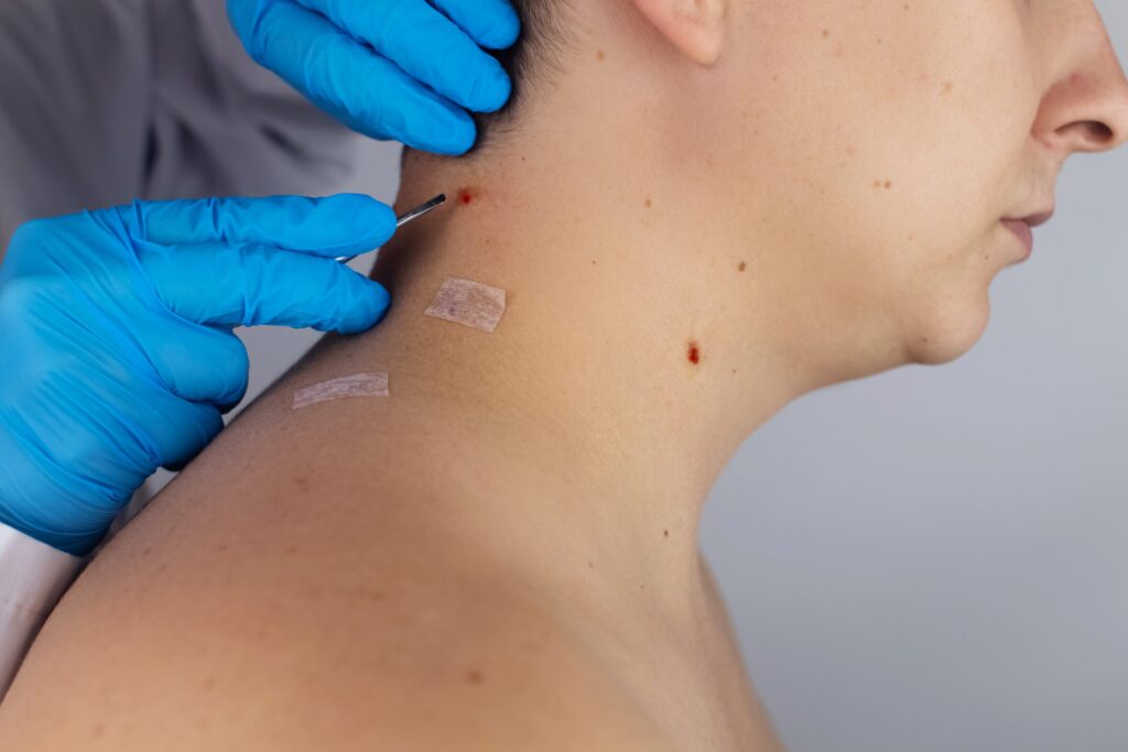 Common types of skin lesions: 5 warning signs your skin lesion could be serious 1 Types of skin lesions