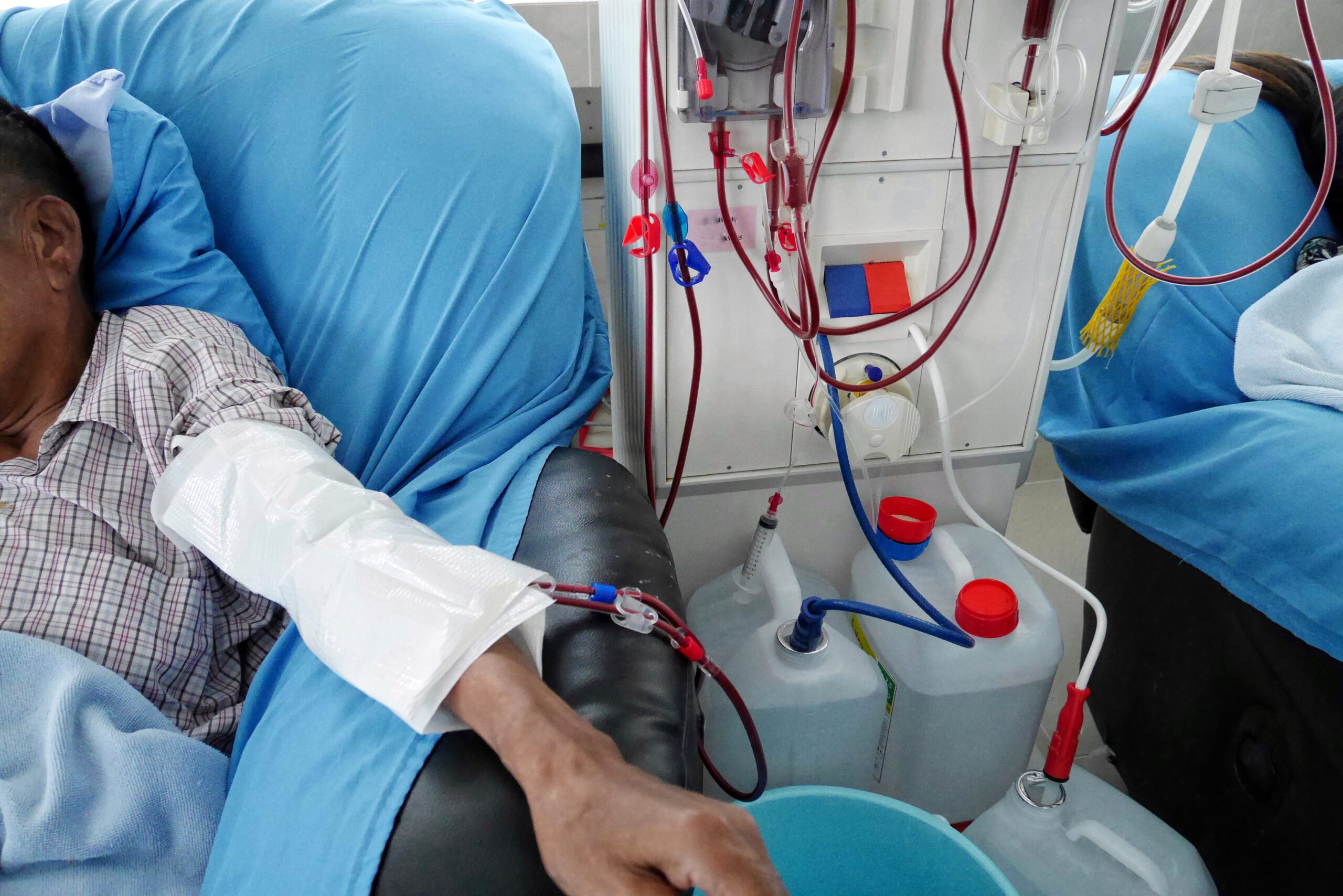 Learn what to expect during kidney dialysis and how to prepare for treatment. Expert tips for physical and emotional support throughout your dialysis journey.