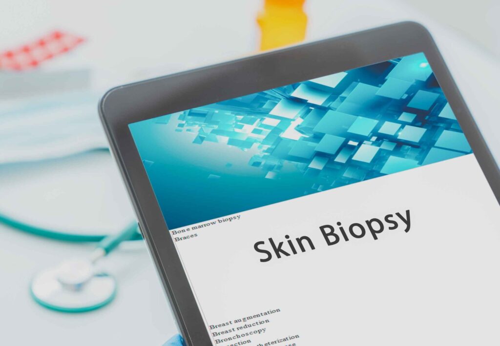 Skin biopsy types: 9 essential facts you must understand 1 Skin biopsy
