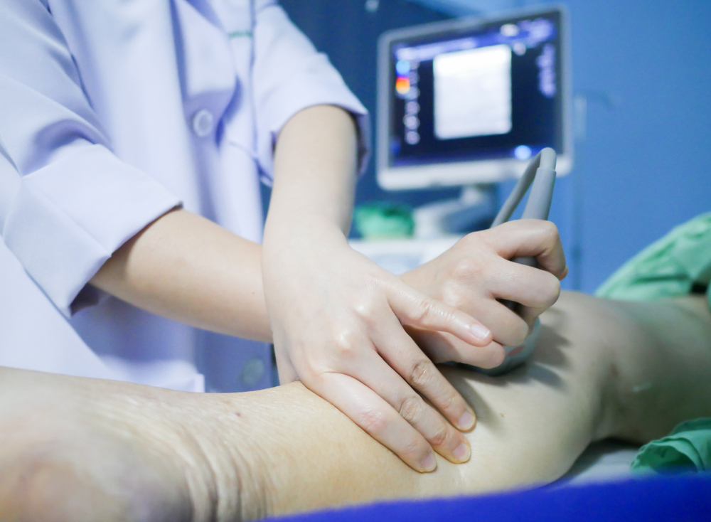 Top 5 signs and symptoms that indicate the need for venous ultrasound 5 Venous ultrasound, signs you need a venous ultrasound