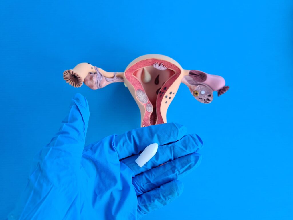Bacterial vaginosis
