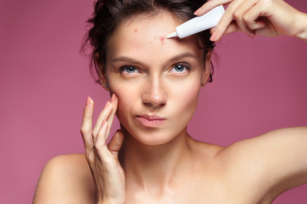 Pimples and your mental health: coping strategies 1 Pimples