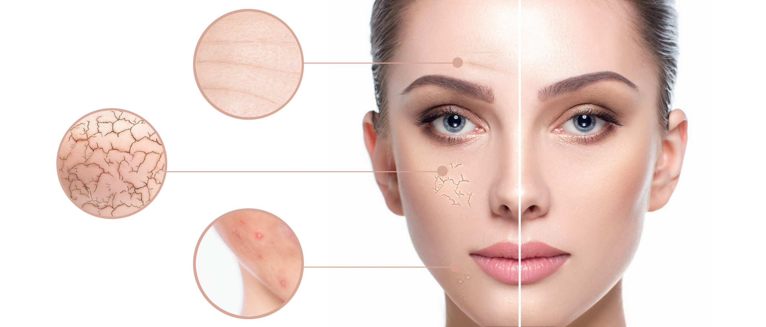 Skin Rejuvenation Treatments
