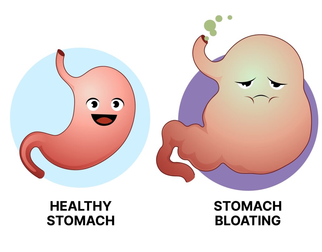 Gut health and its impact on bloating 1 Gut health and bloating