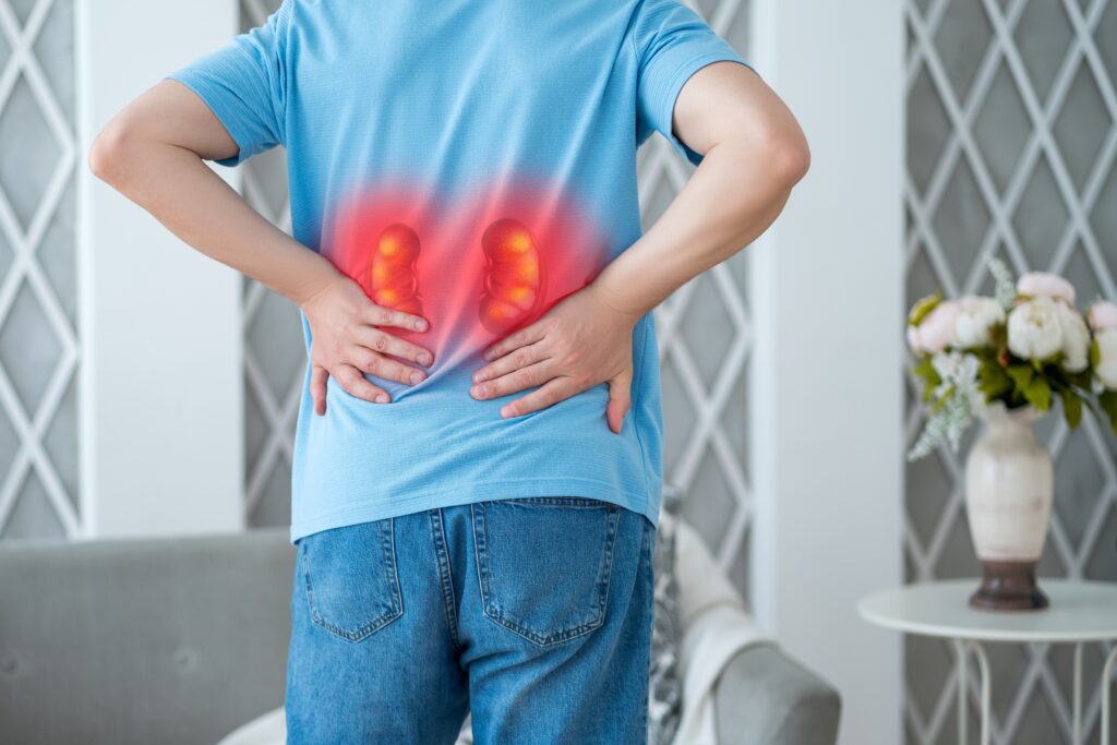 kidney stones