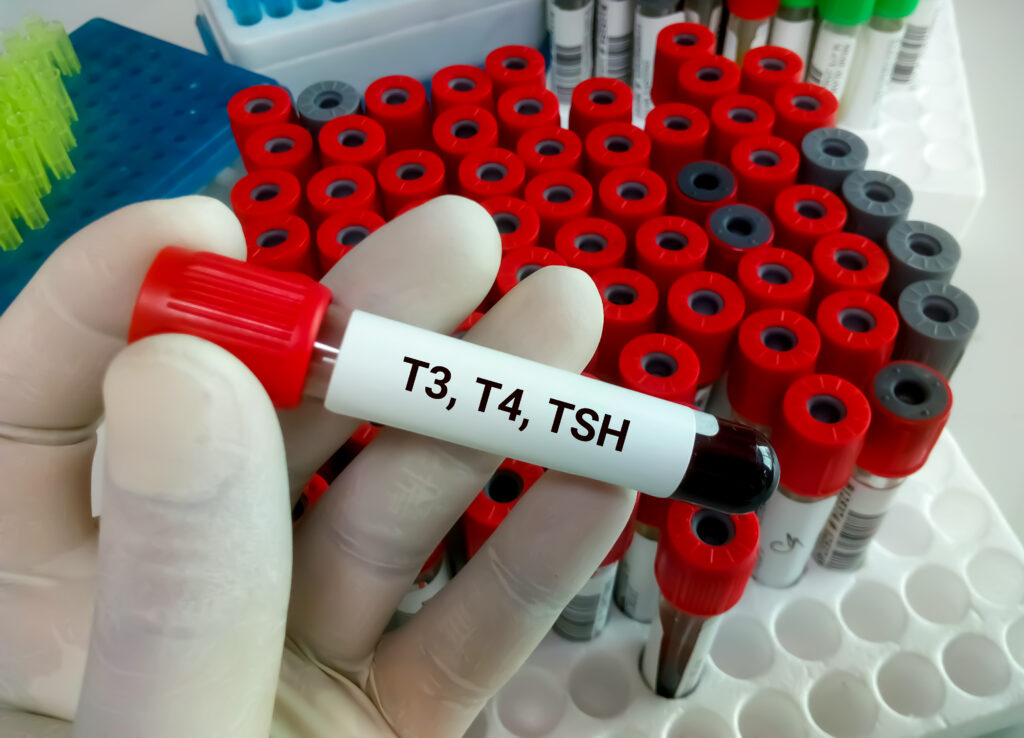 Learn about thyroid hormones T3, T4, and TSH, their vital roles in hormonal health, and how their balance affects your metabolism and overall wellbeing.