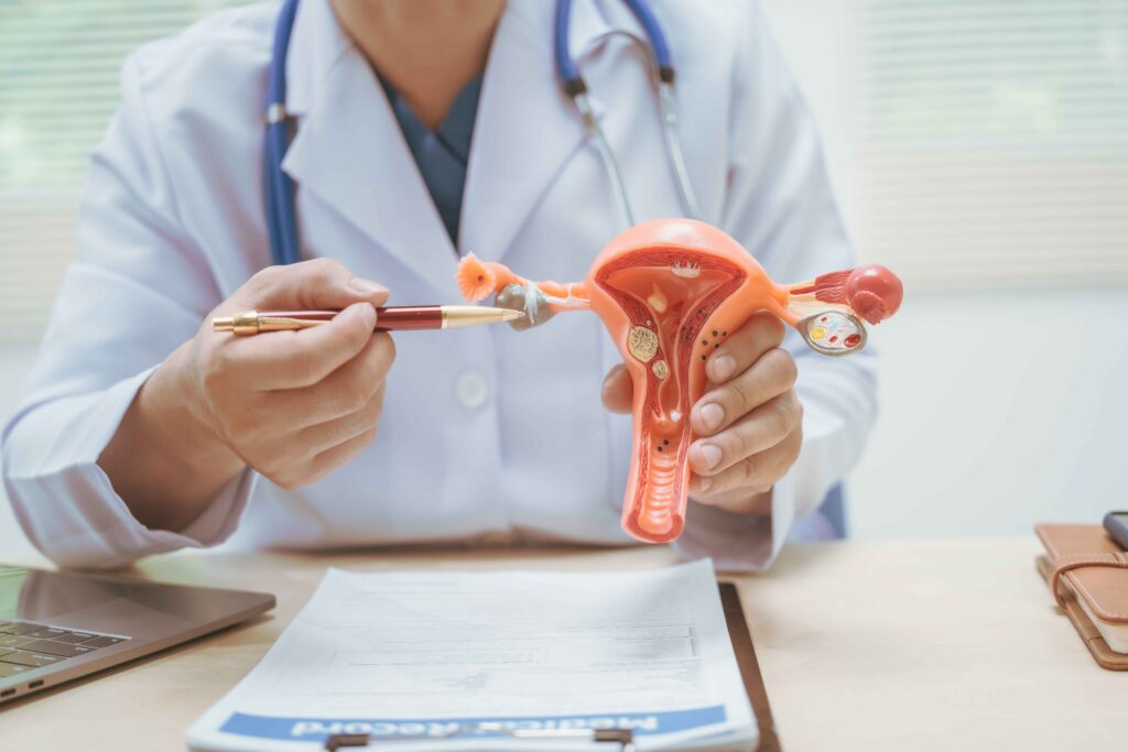 Ovarian cysts
