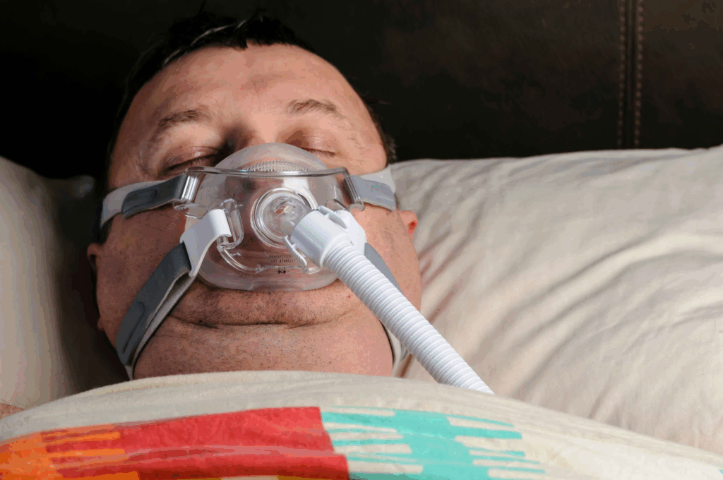 The relationship between sleep apnea and obesity