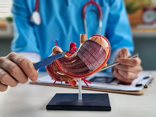 Bariatric surgery