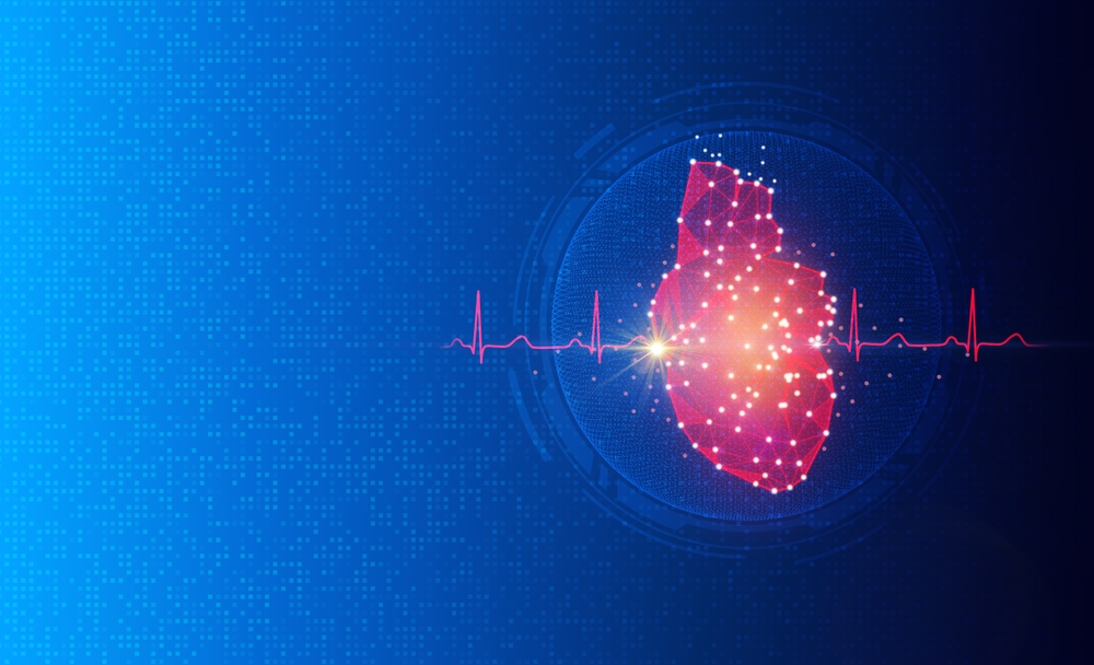 Cardiac ablation 3 Cardiac ablation