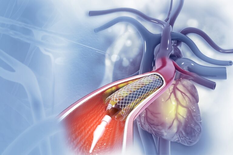 WHAT TO DO BEFORE CARDIAC CATHETERIZATION visual data 6