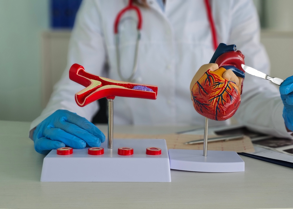 Coronary artery bypass grafting (cabg) 9 Coronary artery bypass grafting (cabg)