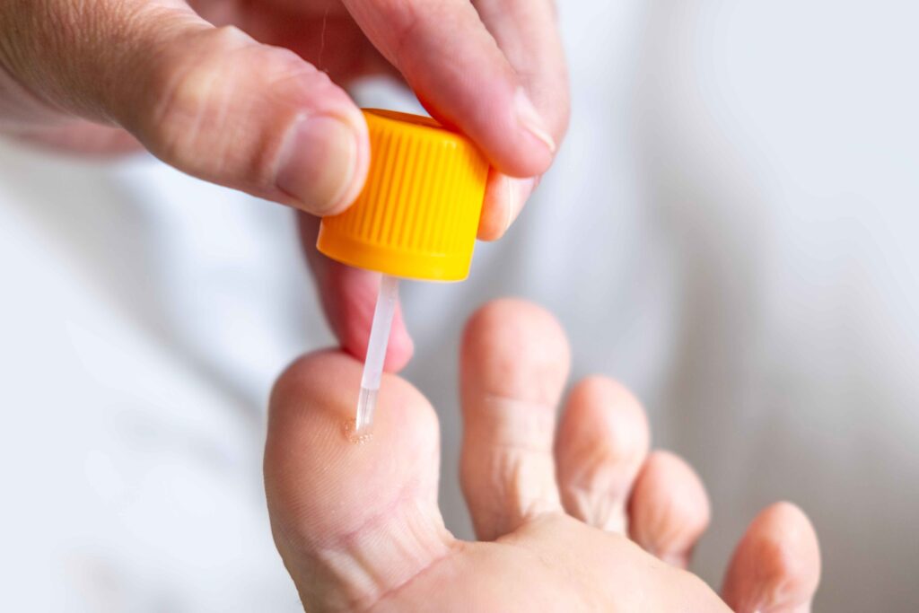 Foot lesion removal 10 Excision or destruction of painful or suspicious skin and soft-tissue lesions of the foot.
