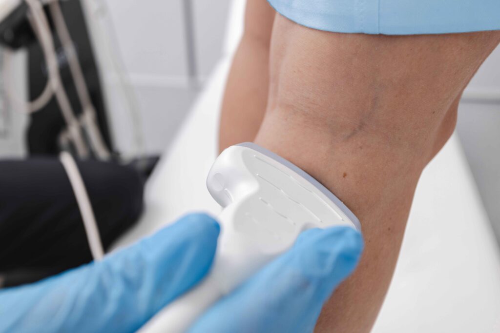 Venous/vascular ultrasound (lower extremity) 3 Duplex ultrasound to evaluate blood flow in the legs and feet.