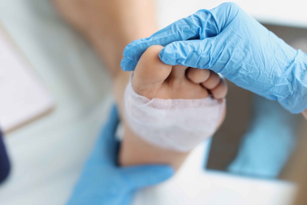 Wound care (foot & ankle) 2 Comprehensive treatment to heal acute and chronic foot wounds