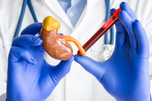 High creatinine levels