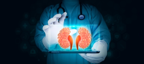 Kidney cysts