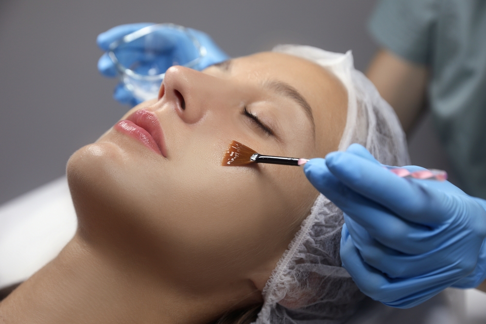 Chemical peels