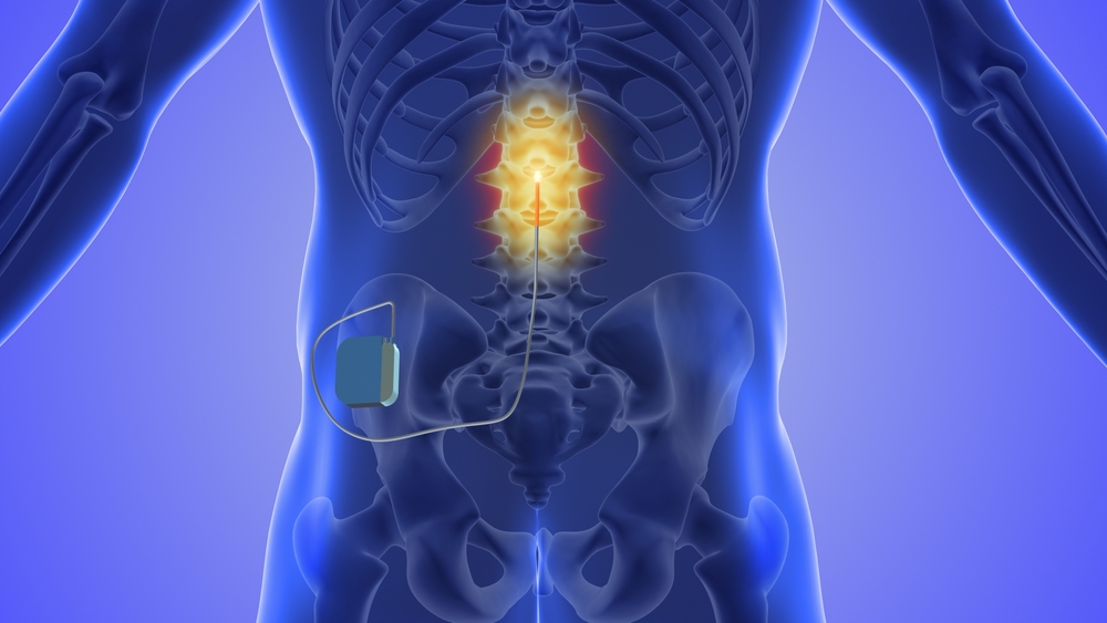 Injecting,steroids,to,treat,herniated,disc,pain,3d,illustration