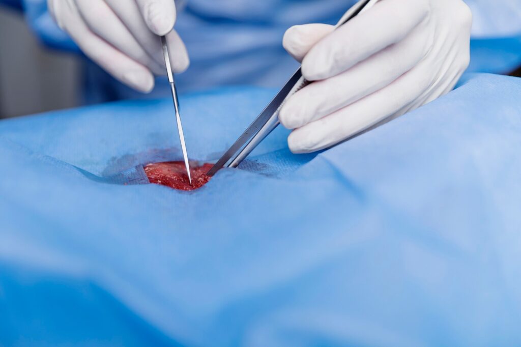 Percutaneous native kidney biopsy