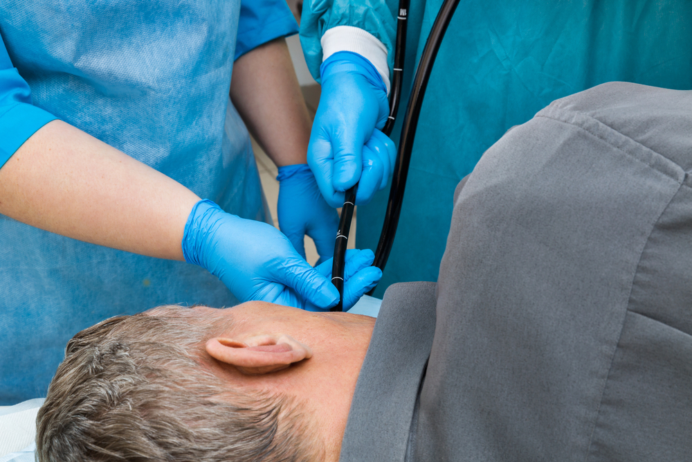 Esophagogastroduodenoscopy (egd) 3 Shutterstock 277116029