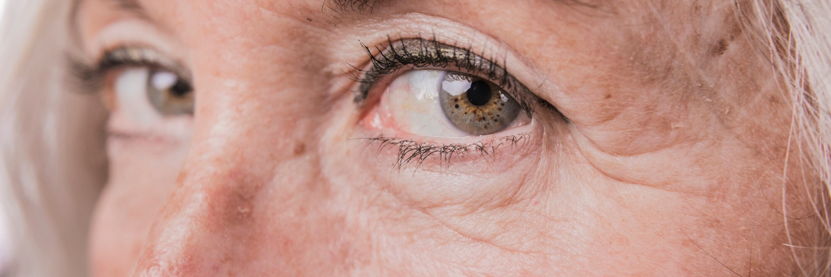 cataract surgery
