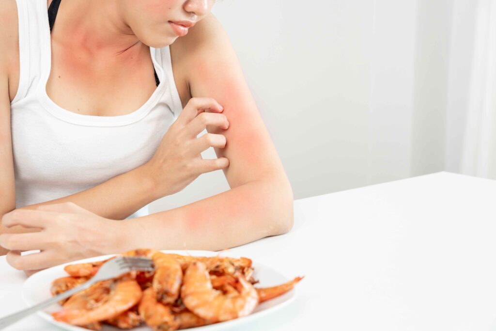 Food allergies 6 Food allergies