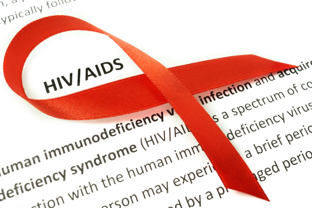 Living a healthy life with hiv/aids  4 Hiv diagnosis u