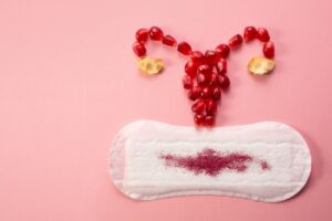 Menorrhagia