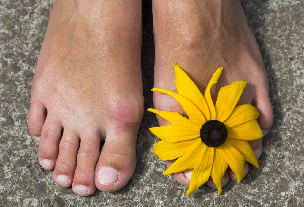 The role of podiatrists in managing arthritis pain 5 Foot u 1