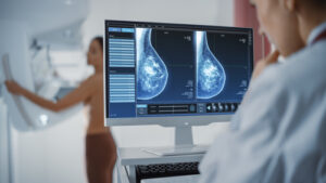 Medical illustration representing triple-negative breast cancer and tumor cells without hormone receptors