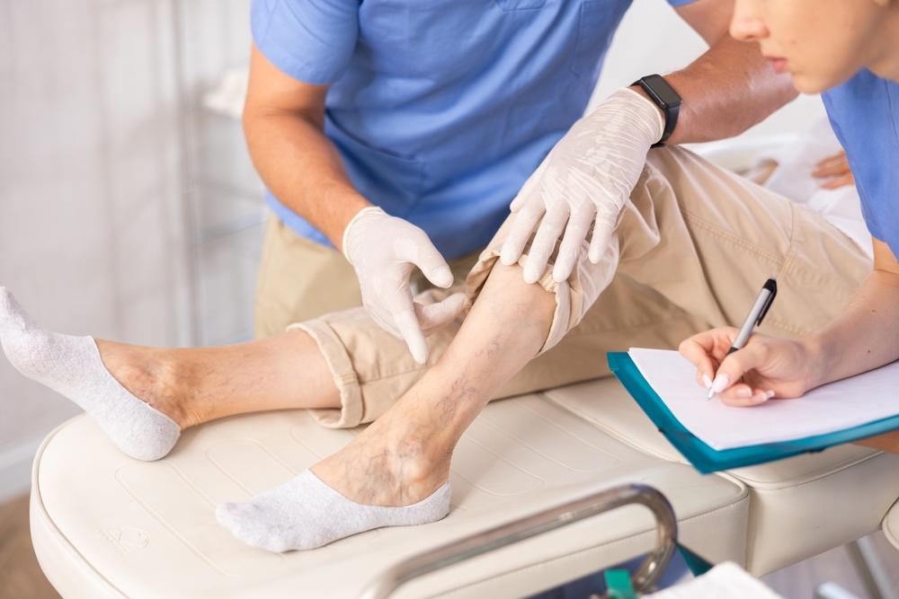 How your lifestyle affects vascular health 2 Vascular health