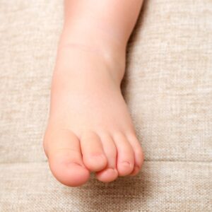 Undulating Toes Underlapping Toes: The Hidden Foot Problem Affecting Gait, Balance, And ...