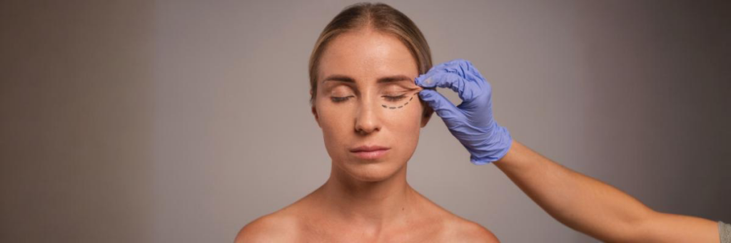 Blepharoplasty basics what you need to know about eye lifts