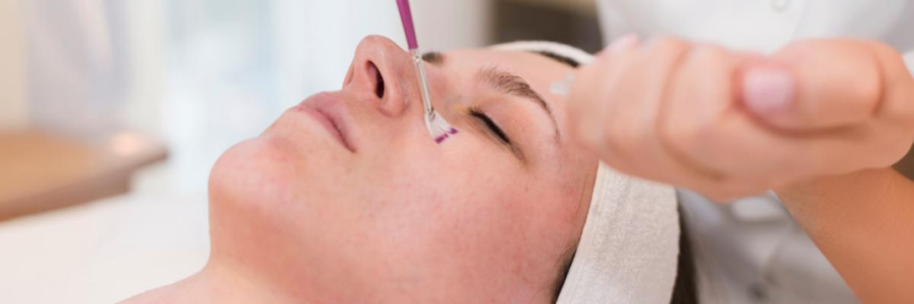 Scar free dreams how microdermabrasion can transform acne scars