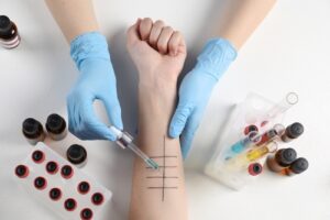 Allergy skin prick test being performed on patient arm to identify allergy triggers quickly
