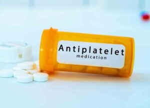 Antiplatelet therapy after pci: 7 next-gen strategies for safer recovery 1 Doctor reviewing heart stent procedure results on a digital screen, representing antiplatelet therapy after pci and cardiovascular care