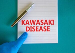 Child with rash and fever symptoms associated with kawasaki disease, including red eyes and strawberry tongue
