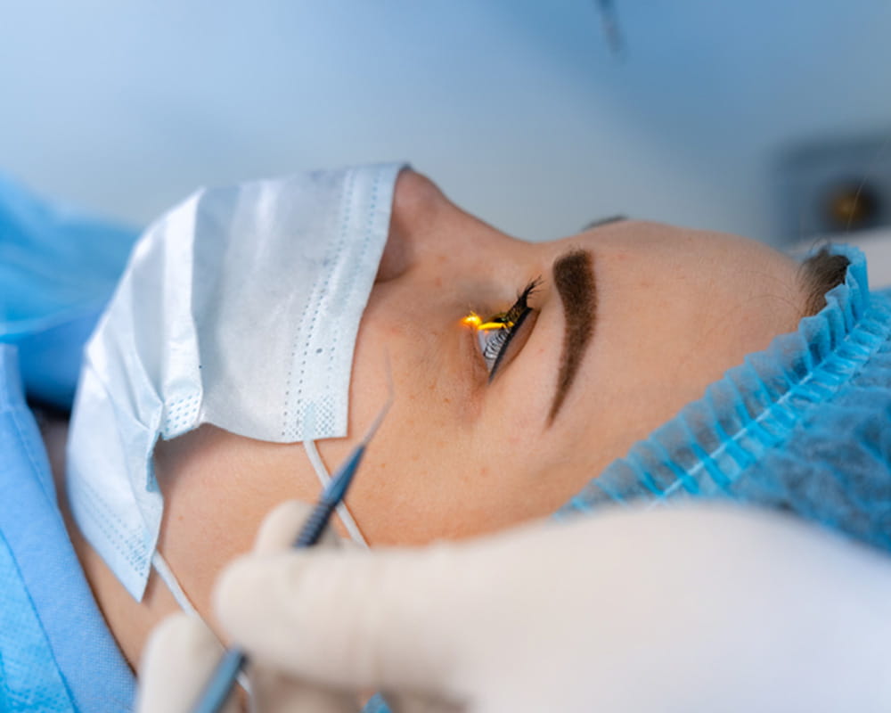 Laser eye surgery
