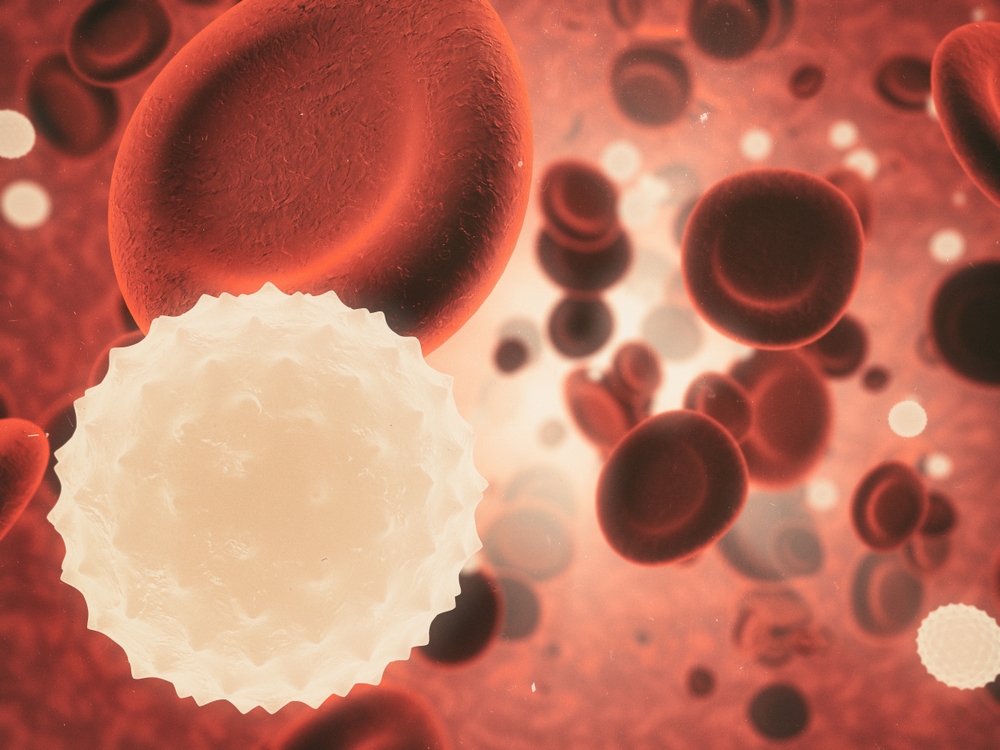 Sepsis