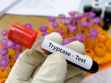 Tryptase test tryptase test can help doctors determine if severe allergic reaction anaphylaxis 595440 2810
