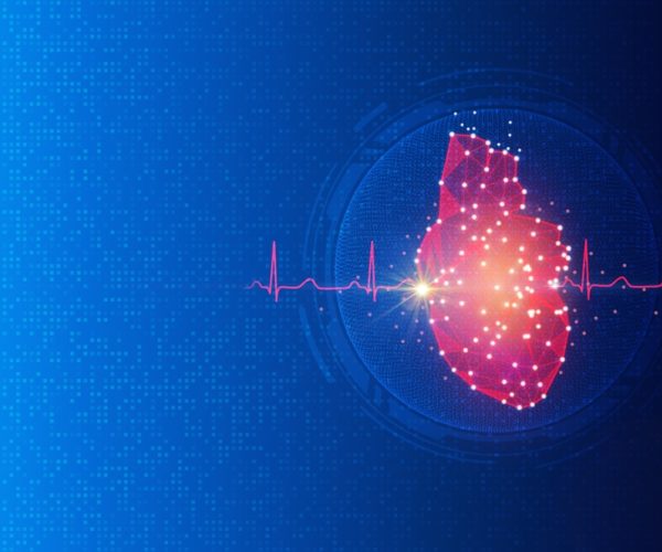 Cardiac Ablation